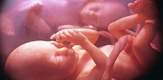 Gemelli salvati nel grembo della mamma affetta da tumore