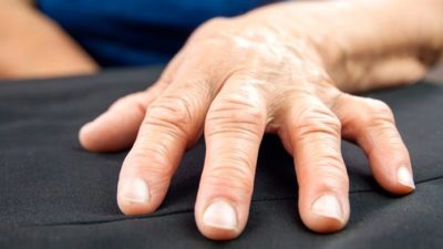 Artrite Reumatoide, la nuova terapia promette la remissione clinica della malattia