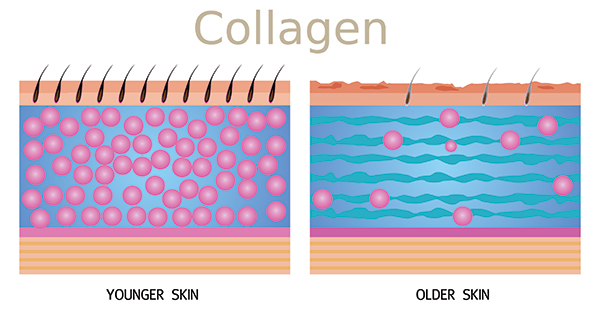 Il collagene, rappresenta la proteina più abbondante del tessuto connettivo, circa l’80% e si forma durante i processi di crescita dei tessuti.