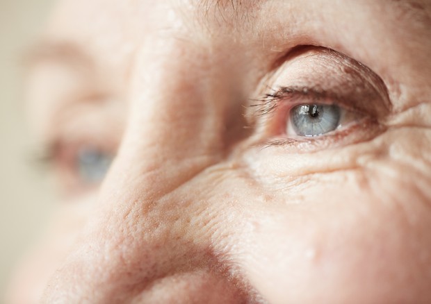Il rischio di Alzheimer si può leggere negli occhi
