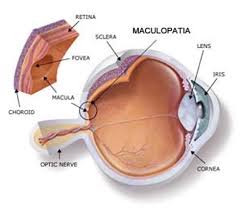 Maculopatia, retina artificiale impiantata su 5 pazienti non vedenti