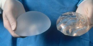 Protesi mammarie: rischio di tumore associato all’impianto