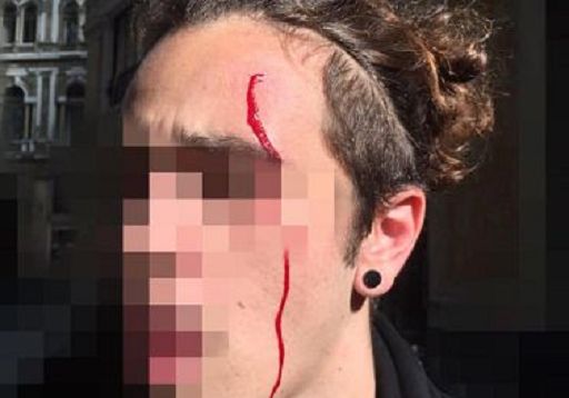 Salvini a Napoli, tensione tra polizia e centri sociali: ferito un manifestante