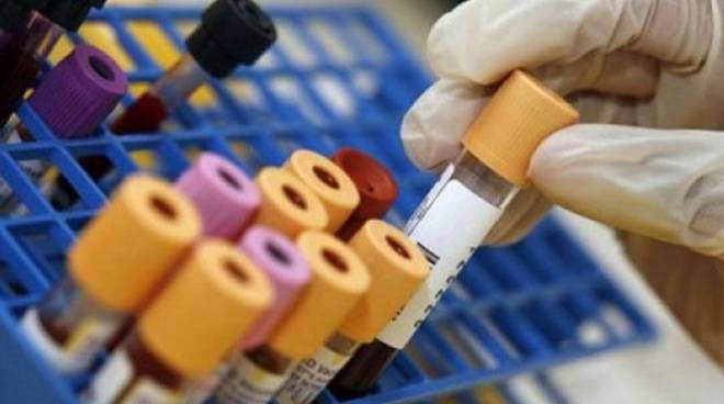 Un vaccino terapeutico italiano per i malati di Aids 