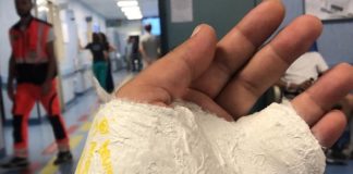 Tassista abusivo aggredisce regolare a Napoli: mano fratturata