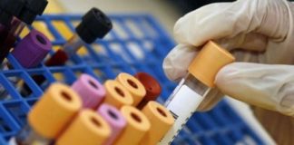 Sanità, no a visite ed esami laboratorio convenzionati fino a ottobre a Napoli, Caserta e Salerno Un test del sangue per la mamma che rivela 1000 malattie genetiche nel feto: la rivoluzione prenatale parte da Napoli