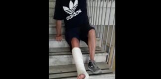 Ospedale Pellegrini, l'ascensore è rotto e il paziente si trascina per le scale