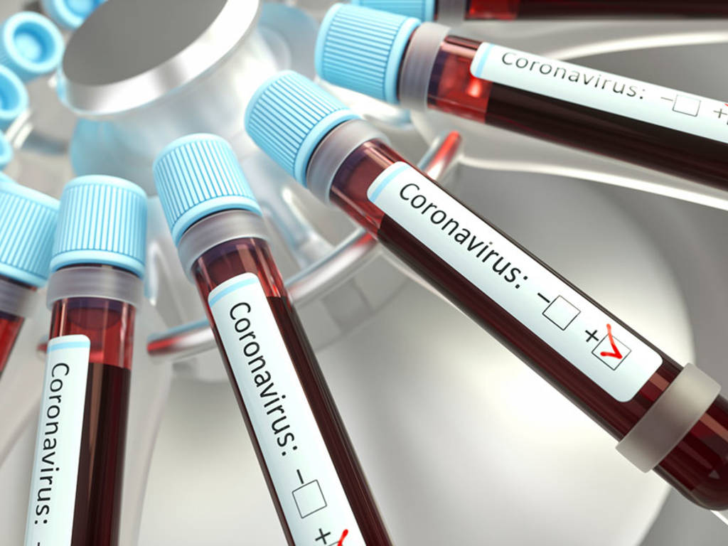 Coronavirus, un gruppo sanguigno corre meno rischi