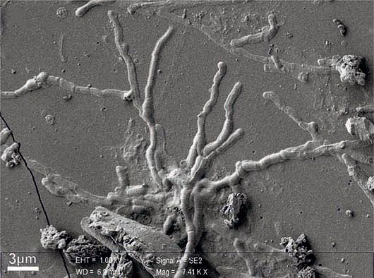 Ercolano e Pompei, scoperti neuroni integri in una vittima dell'eruzione