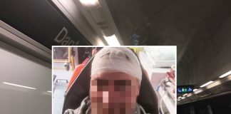 Metropolitana di Napoli, dipendente aggredito con martello