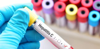 Salerno, morì di epatite dopo trasfusione: maxi risarcimento