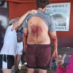 Figav-Confesercenti: incidente turista sul Vesuvio. Nota del presidente Cappelli