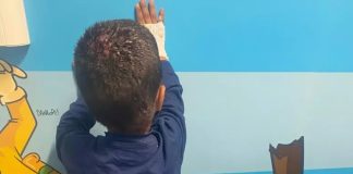 Ospedale Santobono, arriva bimbo di 2 anni da Gaza