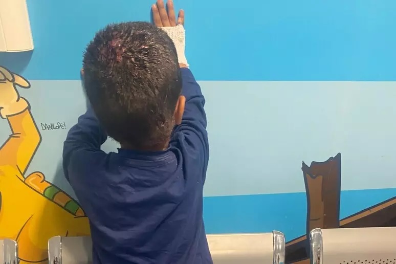 Bimbo di 2 anni dalla striscia di Gaza all’ospedale Santobono di Napoli Bimbo di 2 anni dalla striscia di Gaza all’ospedale Santobono di Napoli